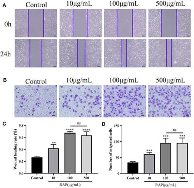 Radix Astragalus Polysaccharide Accelerates Angiogenesis by Activating AKT/eNOS to Promote Nerve Regeneration and Functional Recovery